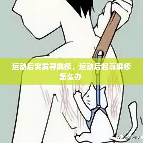 運動(dòng)后突發(fā)尋麻疹，運動(dòng)后起蕁麻疹怎么辦 