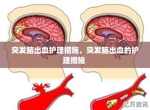 突發(fā)腦出血護理措施，突發(fā)腦出血的護理措施 