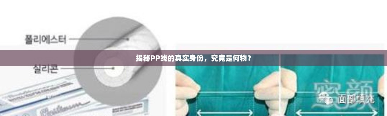 揭秘PP線(xiàn)的真實(shí)身份，究竟是何物？
