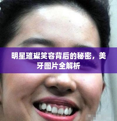 明星璀璨笑容背后的秘密，美牙圖片全解析