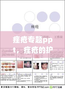 痤瘡專(zhuān)題ppt，痤瘡的護理ppt 