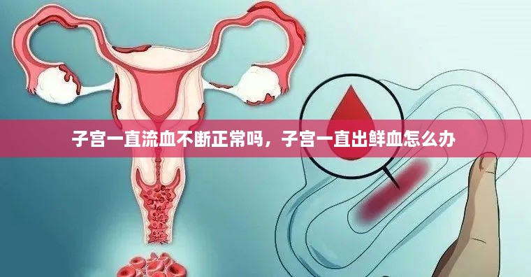 子宮一直流血不斷正常嗎，子宮一直出鮮血怎么辦 