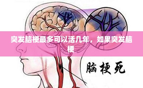 突發(fā)腦梗最多可以活幾年，如果突發(fā)腦梗 