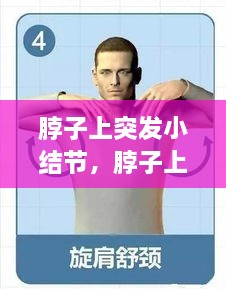 脖子上突發(fā)小結節，脖子上的小結節要緊嗎 