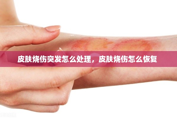 皮膚燒傷突發(fā)怎么處理，皮膚燒傷怎么恢復 