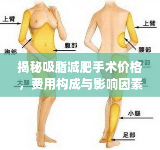 揭秘吸脂減肥手術(shù)價(jià)格，費用構成與影響因素全解析